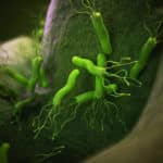 h-pylori