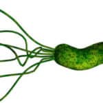 helicobacter-pylori-1-580×290